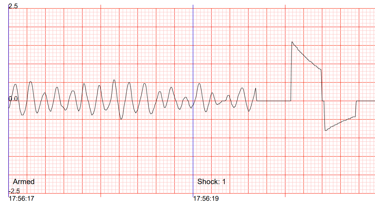 ekg biphasischer schock